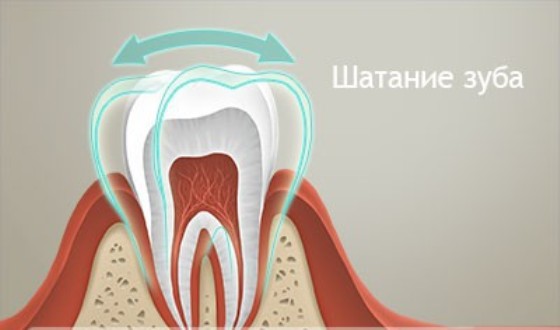 хитання зуба